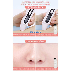 Nước hoa hồng se khít lỗ chân lông, không cồn, dưỡng ẩm, giảm mụn, toner dưỡng da, chống lão hóa Kingdom chiết xuất tinh khiết từ hoa hồng Damask Iran - Hộp 100 ml (có thể uống được)