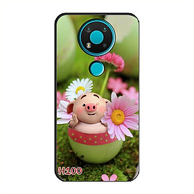 Ốp Dẻo Dành Cho NOKIA 3.4