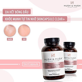 HÀNG NHẬP KHẨU - Viên Uống Ngăn Ngừa Giảm Mụn Image Skincare Hush & Hush