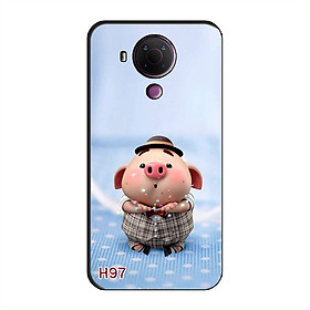 Ốp Lưng Dành Cho NOKIA 5.4