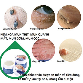 Kem đánh bay mụn thịt, mụn cơm, mụn quanh mắt, nốt ruồi,... thành phần thảo dược thiên nhiên 100%_HBESTY