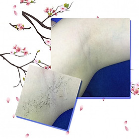 >> SO SÁNH GIÁ MÁY TRIỆT LÔNG OPT ELIGHT BEAUTY | Shopee Lazada Sendo Tiki 20 Liệu trình 20 lần triệt lông vĩnh viễn vùng nách OPT - SHR tại L'AQUA BEAUTY