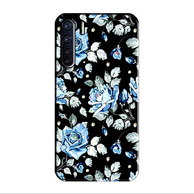 ỐP LƯNG DẺO ĐÍNH ĐÁ DÀNH CHO OPPO RENO 3