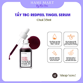 Tinh Chất Thay Da Sinh Học Tẩy Tế Bào Chết da Mặt So’Natural Red Peel Tingle Serum 35ml