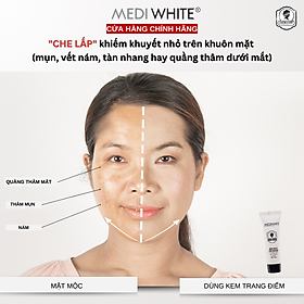 Kem Che Khuyết Điểm Medi White Face Makeup Kích Trắng Da Dưỡng Ẩm Bearberry Vitamin C - E