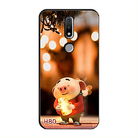 Ốp Lưng Dẻo Dành Cho NOKIA 2.4
