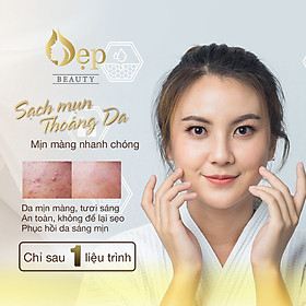 VOUCHER LẤY NHÂN MỤN CHUẨN Y KHOA 90 PHÚT