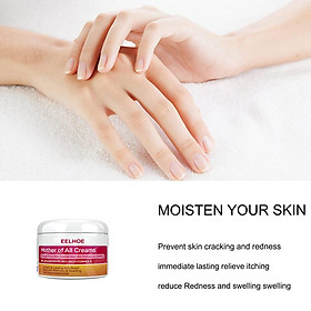 Moisturizing Cream Skin Psoriasis Dermatitis Eczema Ointment Treatment Cream Skin Care Cream