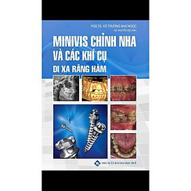 Nơi bán Minivis chỉnh nha và các khí cụ di xa răng hàm - Giá Từ -1đ