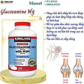 Hình ảnh Glucosamine 1500mg, Chondroitin 1200mg Kirkland Signature Mỹ - Phục hồi sụn khớp, Giảm đau nhức xương khớp và vận động linh hoạt - Massel Official