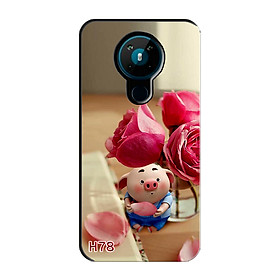 Ốp Lưng Dành Cho NOKIA 5.3