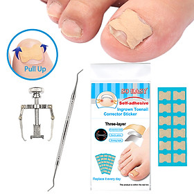 Bộ dụng cụ làm móng gồm miếng dán móng ngược kẹp ngón chân làm thẳng móng