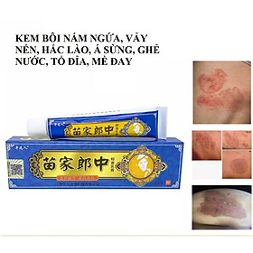 Kem da liễu chuyên bôi nấm ngứa ngoài da
