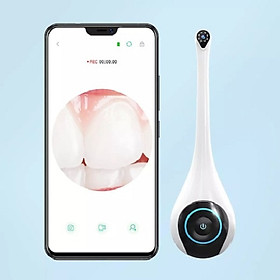 Gương nha khoa trực quan thông minh T5-YPC từ Xiaomi Youpin - Màu trắng
