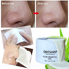 Giấy Lột Mụn Cám - Mụn Đầu Đen OKESHOP - Giải Pháp Cùng Gel Lột Mụn OKESHOP 600 tờ