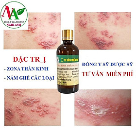 Thảo dược bôi trị zona thần kinh, nấm ghẻ, ngứa dị ứng lọ 100ml