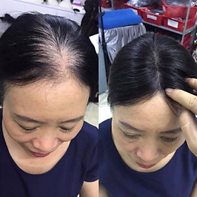 Tóc giả che hói che bạc đỉnh đầu siêu da đầu bằng tóc thật  Shopee Việt Nam