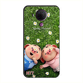 Ốp Lưng Dành Cho NOKIA 5.4