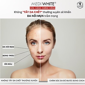 Kem Tẩy Tế Bào chết Medi White Dành Cho Da Nhờn Mụn Giúp Loại Bỏ Tế Bào Da Chết Làm Sáng Da