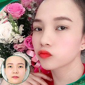Thẩm mỹ Ruby Beauty - Bác sĩ Lương Ngọc|Thẩm mỹ mắt đẹp