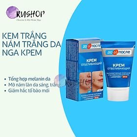 Kem giảm nám xanh Kpem Before and After до и после Nga - Kem giảm nám trắng da Nga Kpem 