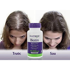 Biotin mọc tóc Natrol Beauty Mỹ hỗ trợ tóc mọc nhanh hơn, dày hơn, cho mái tóc khỏe mạnh, làn da rạng rỡ và móng tay chắc khỏe - QuaTangMe Extaste