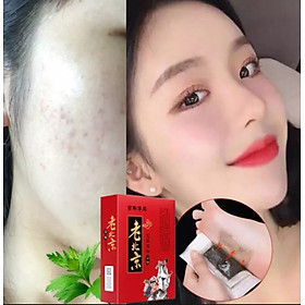 Mua 1 hộp 50 miếng dán chân thải độc và thanh lọc các độc tố trong cơ thể giải độc gan rất tốt sản phẩm có nhiều thành phần từ cây lá nam