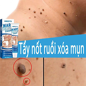 Mua Xóa Mụn Thịt  Nốt Ruồi  Mụn Cóc Nhanh Chóng – Serum Thảo Dược Không Gây Kích Ứng đèn led