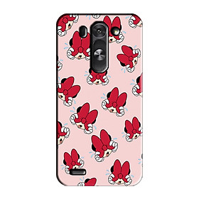 ỐP LƯNG IN DÀNH CHO LG G4