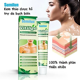 [Vilitigo] Kem Bôi Hắc Lào, Nấm Ngứa, Á Sừng, Lang Ben, Vẩy Nến - Chiết Xuất Thảo Mộc Tự Nhiên, Loại Tốt