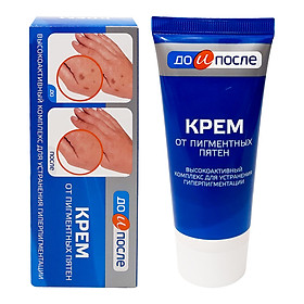 Hình ảnh Review Kem Ngừa Đồi Mồi Và Dưỡng Trắng Da Tay KPEM 50ml NGA