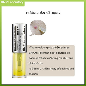 Gel ngừa mụn giảm kích ứng CNP Laboratory Anti-Blemish Spot Solution 3.5ml
