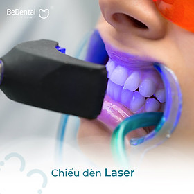 Tẩy trắng răng phương pháp Laser Whitening 5P - Nha khoa BeDental (5 chi nhánh)