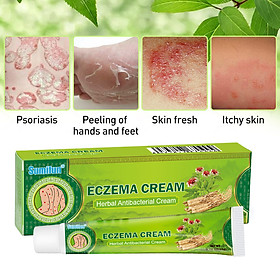 Mua Kem bôi Eczema  chàm khô  chàm nước  ghẻ nước  thành phần thảo dược an toàn tuyệt đối