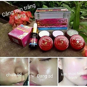 Mua BỘ SẢN PHẨM KEM CHUYÊN TRỊ HẾT NÁM DA SẠM DA DA THÂM LÀM TRẮNG DA DƯỠNG DA CAO CẤP