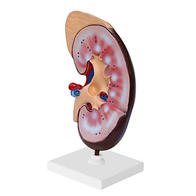 Human Body Kidney Anatomical Model, Educational Tool Teaching Aids, School Learning Tool, Kidney Structure Model
