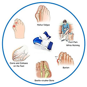 Hình ảnh Nẹp duỗi thẳng cho người vẹo ngón chân cái, bộ 2 cái
