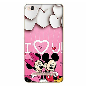 Ốp Lưng Dành Cho Điện Thoại Xiaomi Redmi 4A - I Love You