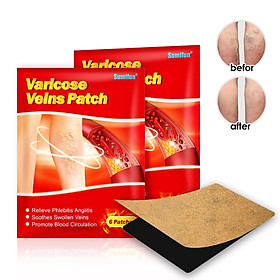 Hình ảnh sách 12Pcs Chinese Varicose Veins Plaster Varicosity Herbal Back Patch 7x10 cm