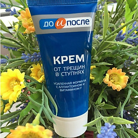 Kem dưỡng ngăn ngừa nứt gót chân Kpem Cream for Carcks in the feet 50ml