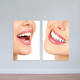Mua Bộ 2 tranh Răng sứ hoàn mỹ | Tranh đẹp phòng nha W2023