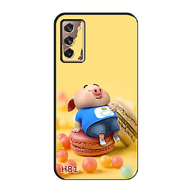 Ốp Lưng Dành Cho SAMSUNG GALAXY Z FOLD 2
