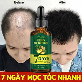 Mua Tinh Dầu Xịt Mọc Tóc EELHOE: Tinh Chất Nhân Sâm và Gừng Tươi Thiên Nhiên Kích Thích Mọc Tóc Sau 7 Ngày Loại Tốt
