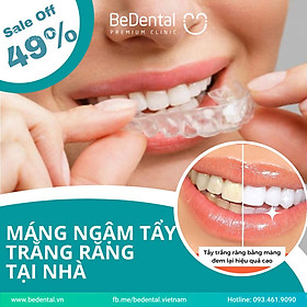Voucher Máng ngậm tẩy trắng răng tại nhà - Nha khoa BeDental
