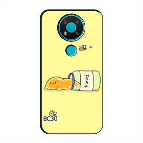 Ốp Dẻo Dành Cho NOKIA 3.4