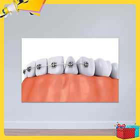 Mua Tranh nha khoa minh họa niềng răng | Tranh treo tường phòng răng W3363