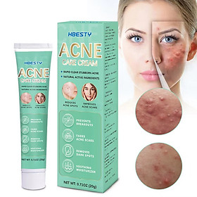 Mua Kem da liễu đánh bay mụn trứng cá  mụn bọc  mụn mủ  mụn đầu đen  ... thành phần tự nhiên 100%_HBESTY