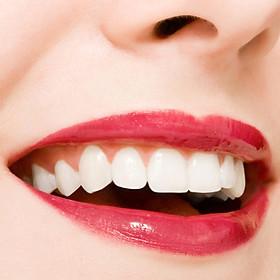 Dịch Vụ tẩy trắng răng công nghệ plasma/ laser whitening - Nha khoa Đăng Khang