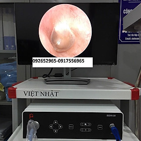 Mua Máy nội soi tai mũi họng Geiwre HD 810