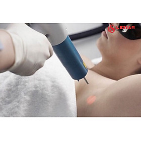 TRẺ HÓA LÀM SÁNG VÙNG NÁCH TẠI VIỆN THẨM MỸ LES SAM